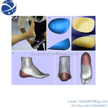 Высокоточный 3D-сканер стопы Pro HD для сканирования любых суставов, мышц или деформированной костной массы.